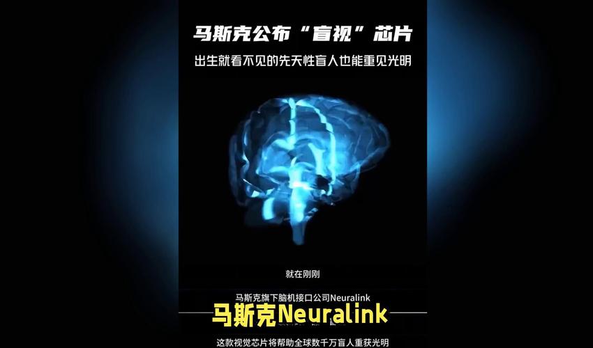 马斯克发明植入脑机接口_马斯克脑机技术_未来趋势：马斯克推动Neuralink在2025年为部分患者进行脑机设备植入